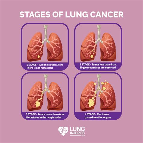 what lung cancer feels like